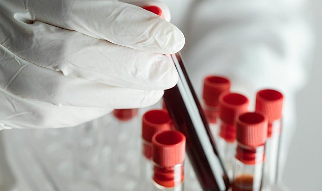 Dünyada sadece 50 kişide var! 'Altın kan'ın sırrı çözülüyor: Bir damlası bile servet değerinde!