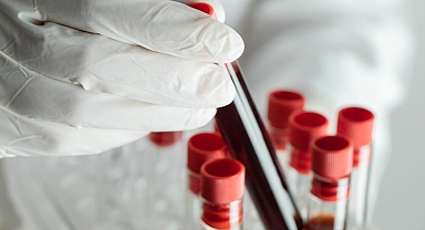 Dünyada sadece 50 kişide var! 'Altın kan'ın sırrı çözülüyor: Bir damlası bile servet değerinde!