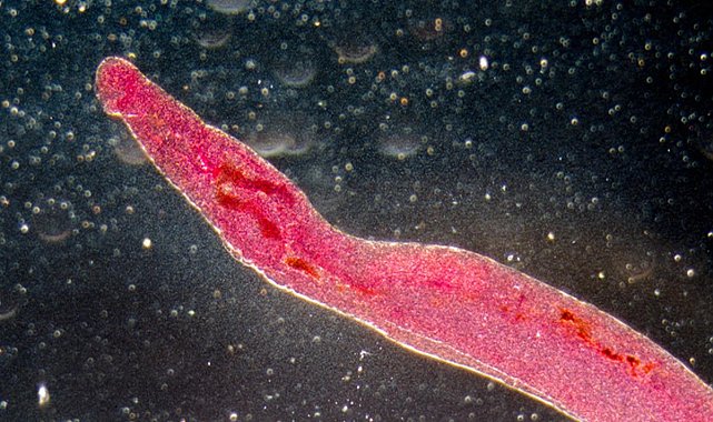 Küresel salgın tehdidi: Cinsel organlara yerleşen parazit yayılabilir!