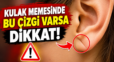 Kulak memenizde bu çizgi varsa dikkat!