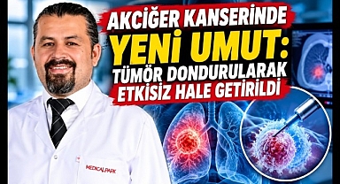 Akciğer Kanserinde Yeni Umut: Tümör Dondurularak Etkisiz Hale Getirildi